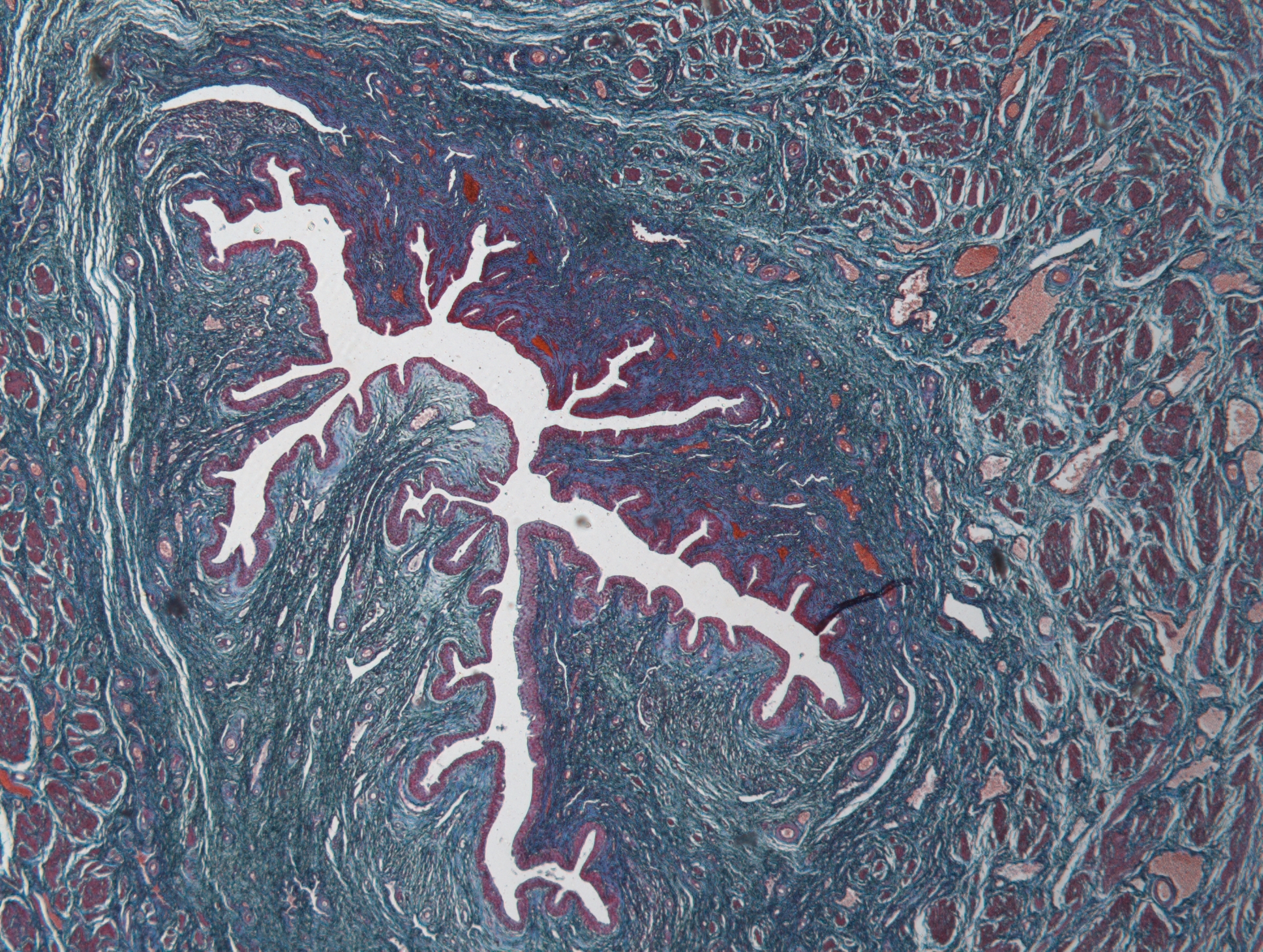 histología de la uretra esponjosa