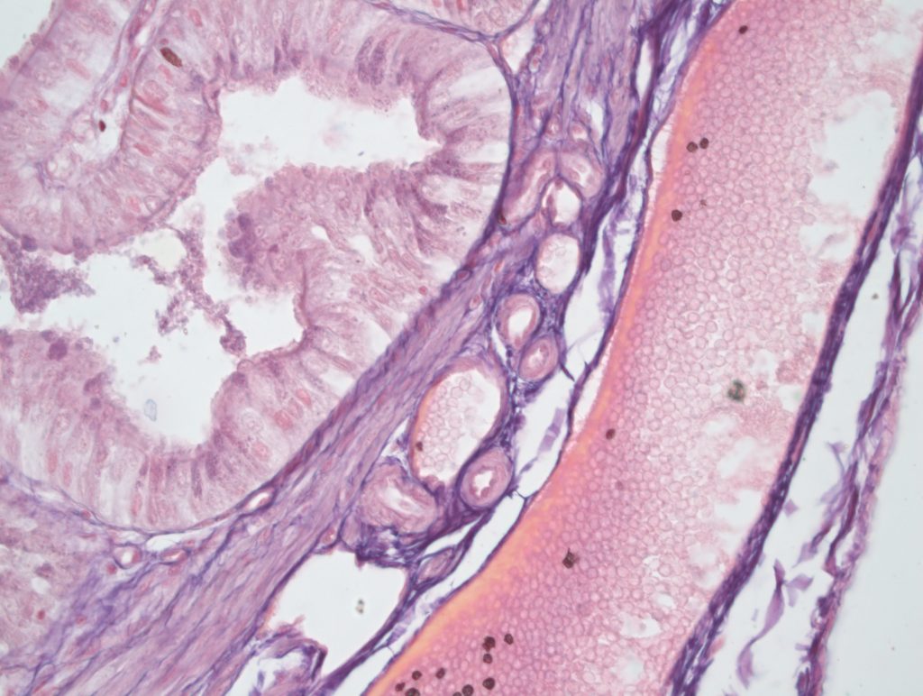 Tuba Uterina Atlas Virtual de Histologia Tuba Uterina Atlas Virtual de Histologia
