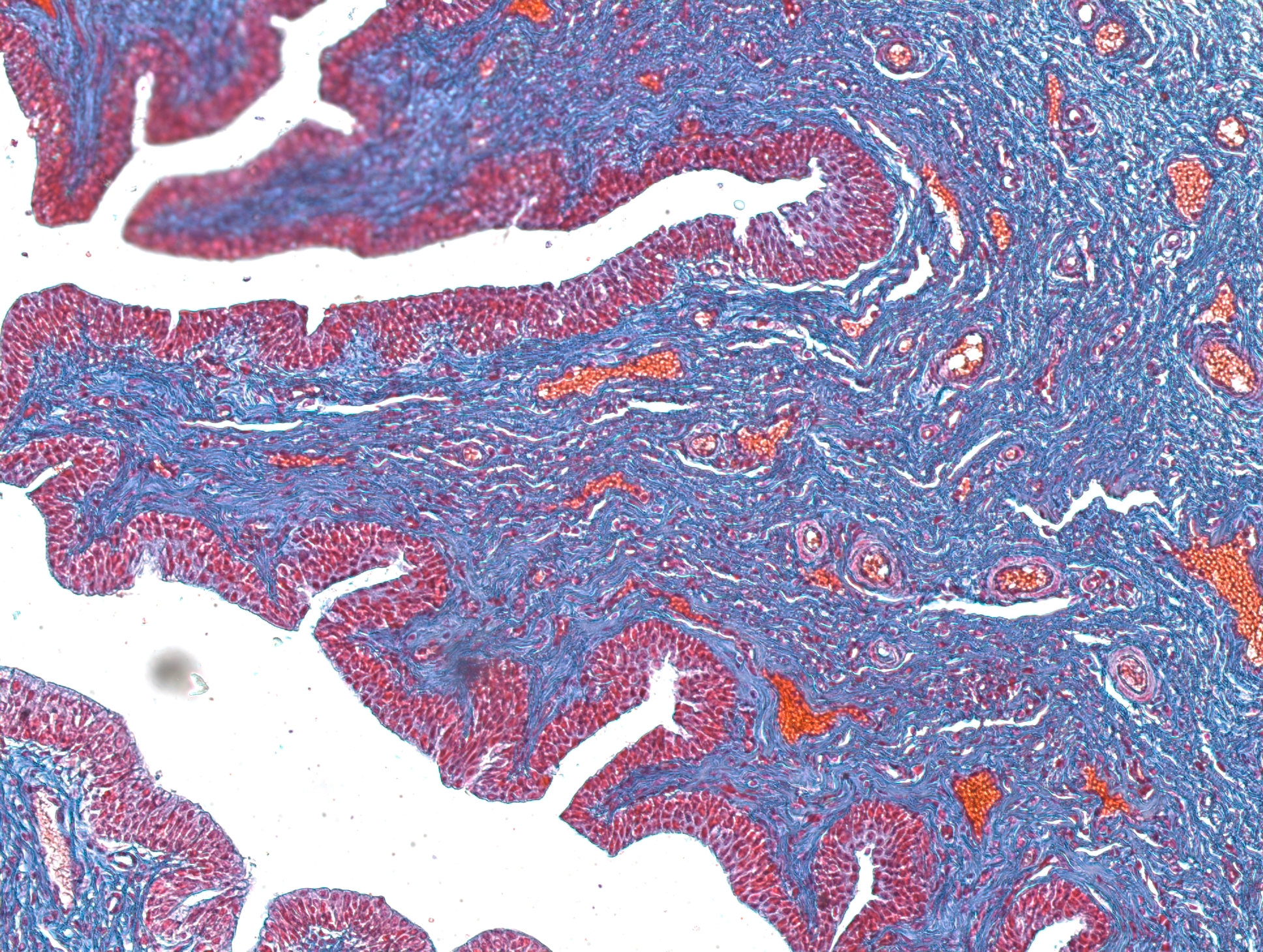 histología de la uretra esponjosa