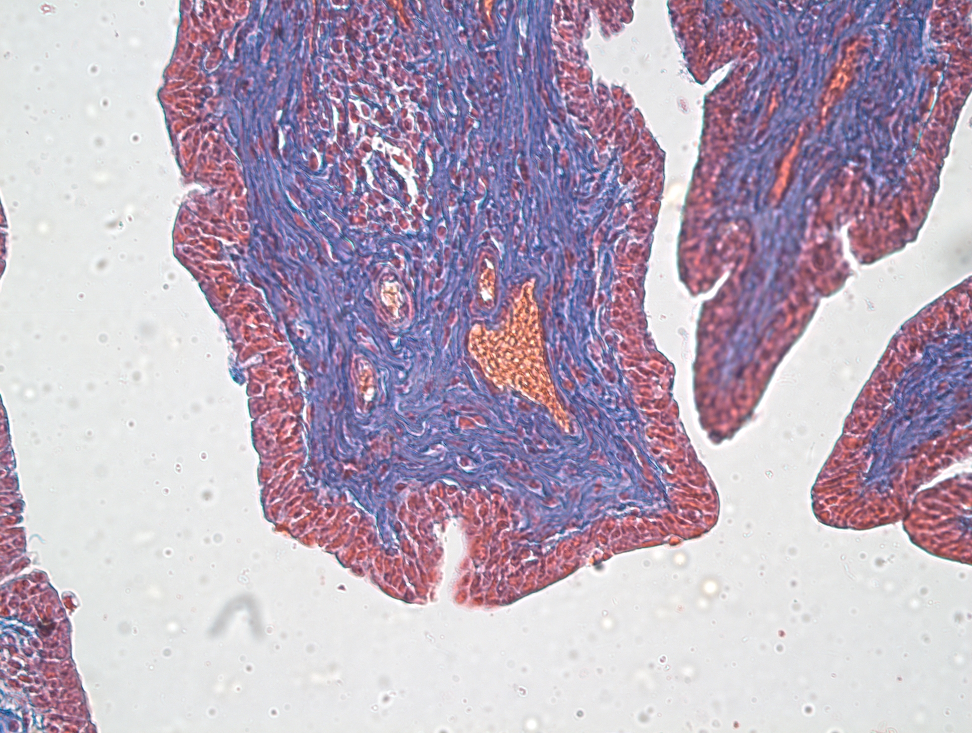 histología de la uretra esponjosa